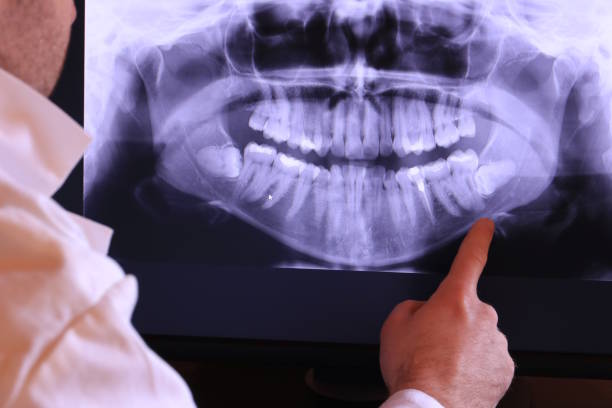 Best Emergency Dentist for Knocked-Out Tooth in Clarks Green, PA